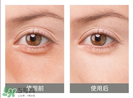 卡琳朵貴婦蛇毒眼膜貼怎么用?使用方法 卡琳朵貴婦蛇毒眼膜貼怎么用?使用方法