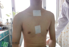 三九貼怎么貼？三九貼的貼法