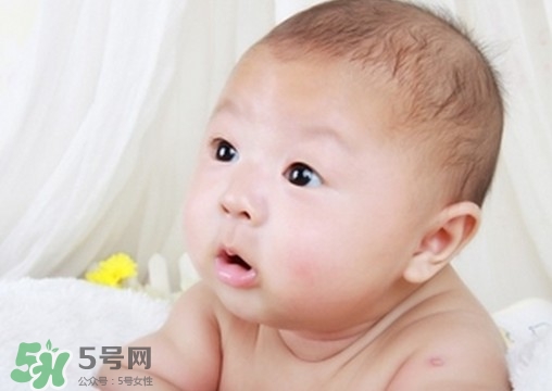 新生兒頭發(fā)黃是什么原因?新生兒頭發(fā)黃怎么辦? 新生兒頭發(fā)黃是什么原因?新生兒頭發(fā)黃怎么辦?