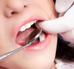 智齒拔完后有個洞怎么辦？拔智齒后有個洞多久能長好？