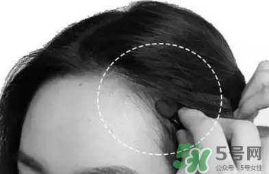 發(fā)際線高適合什么發(fā)型？發(fā)際線高怎么辦