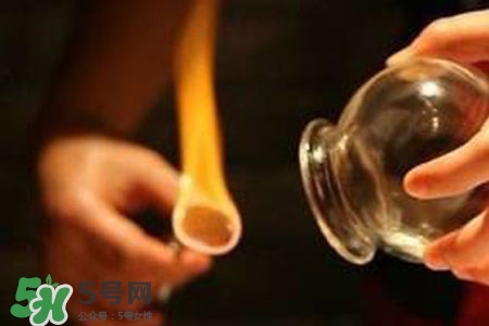 拔罐放血能治皮膚病嗎？拔罐放血能治牛皮癬嗎？