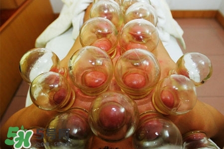 拔罐放血能治皮膚病嗎？拔罐放血能治牛皮癬嗎？