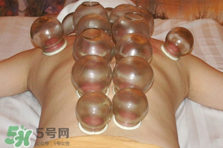 拔罐分季節(jié)嗎？不同季節(jié)的拔罐禁忌