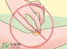 水泡怎么處理？水泡要不要刺破？