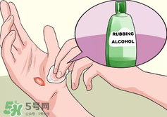 水泡怎么處理？水泡要不要刺破？