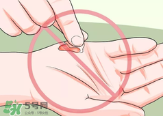 水泡怎么處理？水泡要不要刺破？