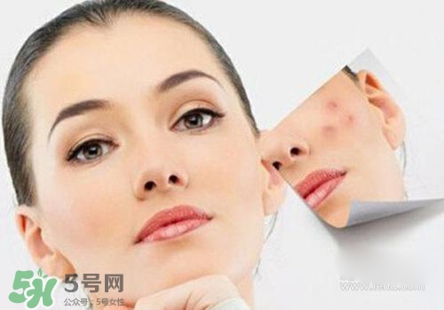 封閉性粉刺會(huì)自己消失嗎？封閉性粉刺好了會(huì)留疤嗎？