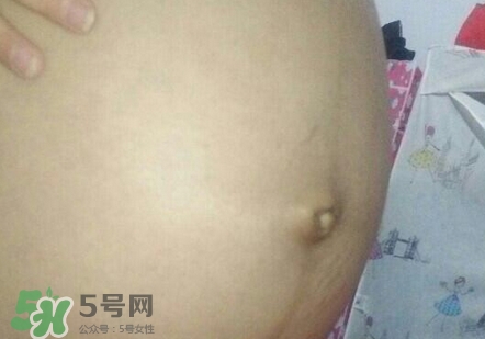 產(chǎn)后肚臍眼臭是怎么回事?產(chǎn)后肚臍眼臭怎么辦?