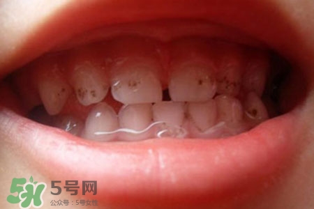 刷牙后吃東西發(fā)苦正常嗎？為什么刷牙后吃東西發(fā)苦？