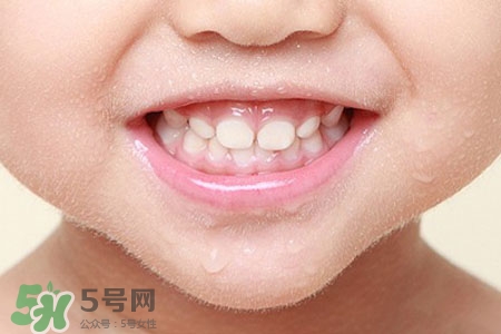 刷牙后吃東西發(fā)苦正常嗎？為什么刷牙后吃東西發(fā)苦？