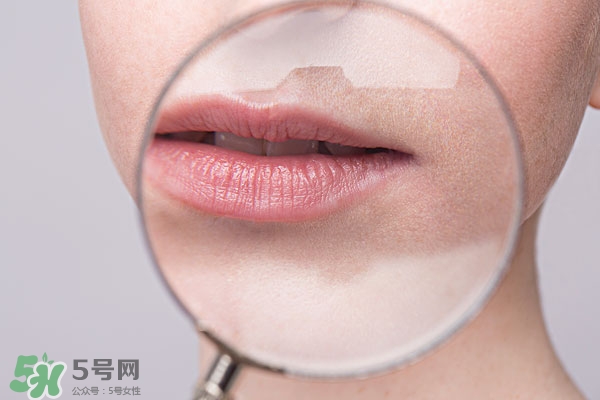 嘴唇起泡腫了怎么辦？嘴唇起泡腫了怎么消腫