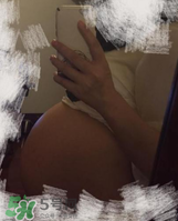 預(yù)防妊娠紋用什么好？懷孕期間如何預(yù)防妊娠紋