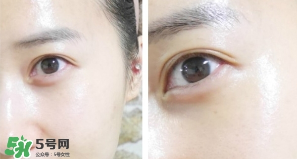 水光面膜用完要洗嗎？水光面膜用完要洗臉嗎