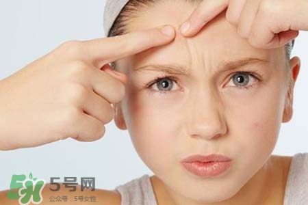 春天臉上冒痘痘怎么辦？為什么春天臉上容易出痘？