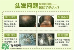 牛角梳梳頭可以生發(fā)嗎？牛角梳怎么梳頭？