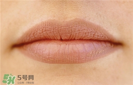 卡唇紋是什么意思？卡唇紋怎么辦？