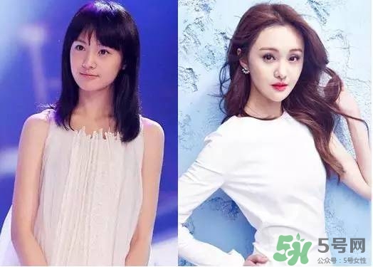 瘦臉針進(jìn)口好還是國(guó)產(chǎn)好？瘦臉針國(guó)產(chǎn)和進(jìn)口的區(qū)別