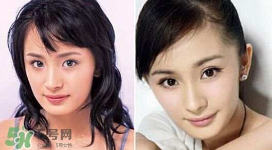 打瘦臉針能懷孕嗎？打瘦臉針能吃避孕藥嗎？