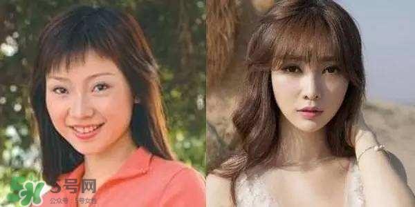 打瘦臉針能懷孕嗎？打瘦臉針能吃避孕藥嗎？