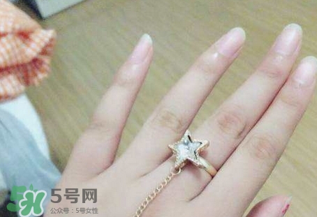 手上長倒刺可以拔嗎?手上長倒刺能拔嗎? 手上長倒刺可以拔嗎?手上長倒刺能拔嗎?