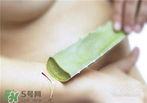 蘆薈涂在臉上發(fā)癢是怎么回事？蘆薈涂在臉上發(fā)癢怎么辦？