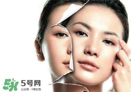 美白針是什么？美白針可以連續(xù)打嗎？