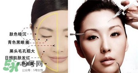 美白針的效果明顯嗎？美白針一個療程幾次？