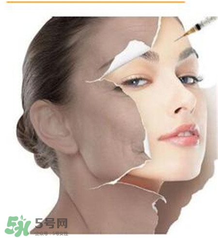 美白針安全嗎？美白針可以自己注射嗎？