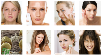 香皂洗臉可以去黑頭嗎 用香皂洗臉的好處 香皂洗臉可以去黑頭嗎 用香皂洗臉的好處