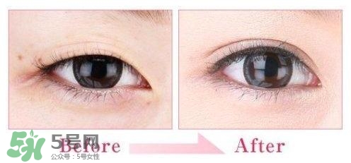 割雙眼皮多少錢(qián)？割雙眼皮最佳年齡