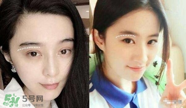 割雙眼皮有幾種做法？雙眼皮有哪幾種形狀？