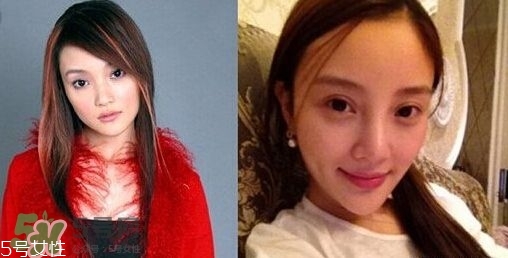 割雙眼皮有幾種做法？雙眼皮有哪幾種形狀？