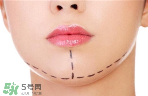 玻尿酸墊下巴能維持多久？玻尿酸墊下巴能維持多長(zhǎng)時(shí)間？