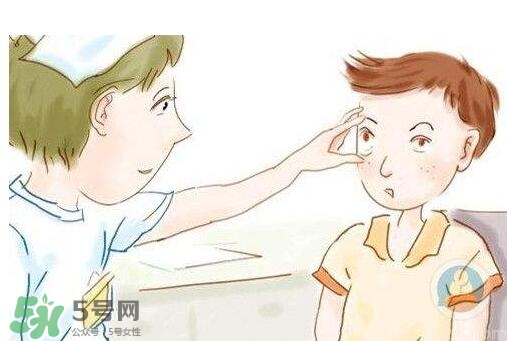 紅眼病用什么眼藥水好？紅眼病吃什么好得快