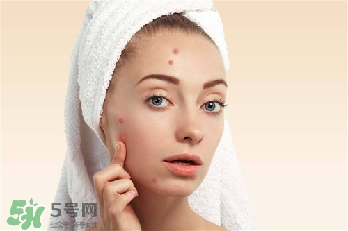 激光祛痘印有副作用嗎？激光去痘印有后遺癥嗎？