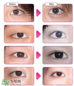 哪些人需要開眼角？需要開眼角的眼睛圖片