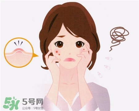 一化妝就長閉口怎么回事?長閉口可以化妝嗎? 一化妝就長閉口怎么回事?長閉口可以化妝嗎?