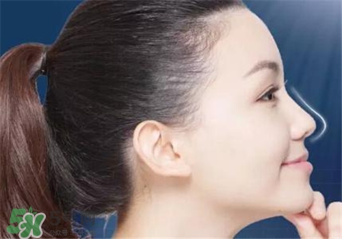 隆鼻會(huì)拉近眼距嗎？隆鼻會(huì)改變眼睛嗎？