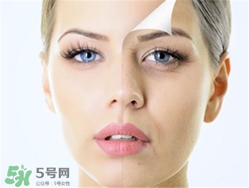 玻尿酸除皺有效果嗎？玻尿酸除皺效果怎么樣？