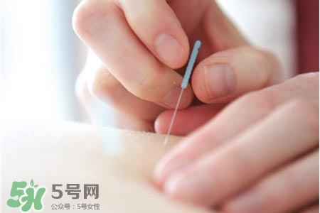 沒病可以針灸嗎？沒病可以扎針嗎？