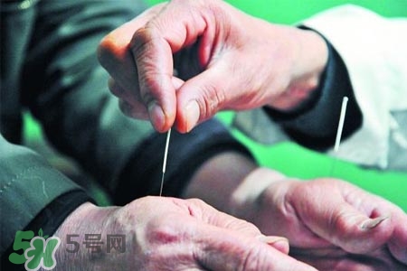 沒病可以針灸嗎？沒病可以扎針嗎？