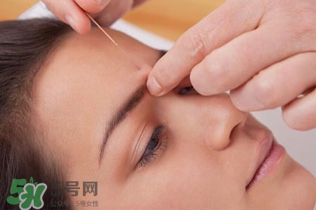 沒病可以針灸嗎？沒病可以扎針嗎？