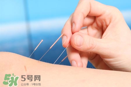 沒病可以針灸嗎？沒病可以扎針嗎？