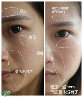 赫拉氣墊用了悶痘嗎？赫拉氣墊悶痘怎么辦？