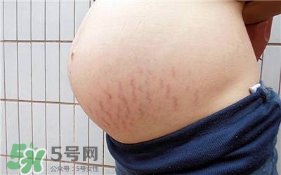 妊娠紋幾個(gè)月開始出現(xiàn)？妊娠紋能消除掉嗎？