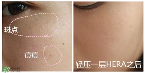 赫拉氣墊用了悶痘嗎？赫拉氣墊悶痘怎么辦？