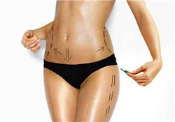 抽脂會留下疤痕嗎？抽脂會不會留疤？