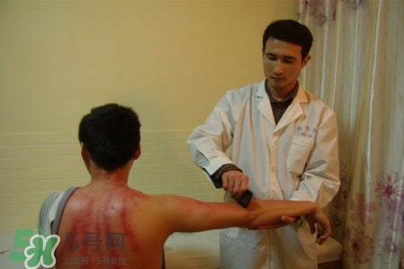 骨質(zhì)疏松可以刮痧嗎？骨質(zhì)疏松刮痧好嗎？