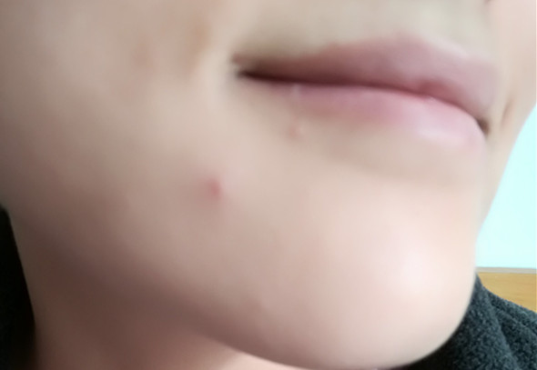 美康粉黛適合什么年齡？美康粉黛適合年齡段